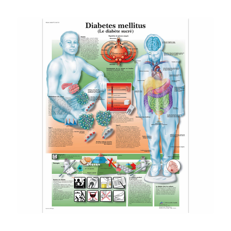 Planche anatomique - Le diabète - Anatomie et pathologie - 3B Scientific