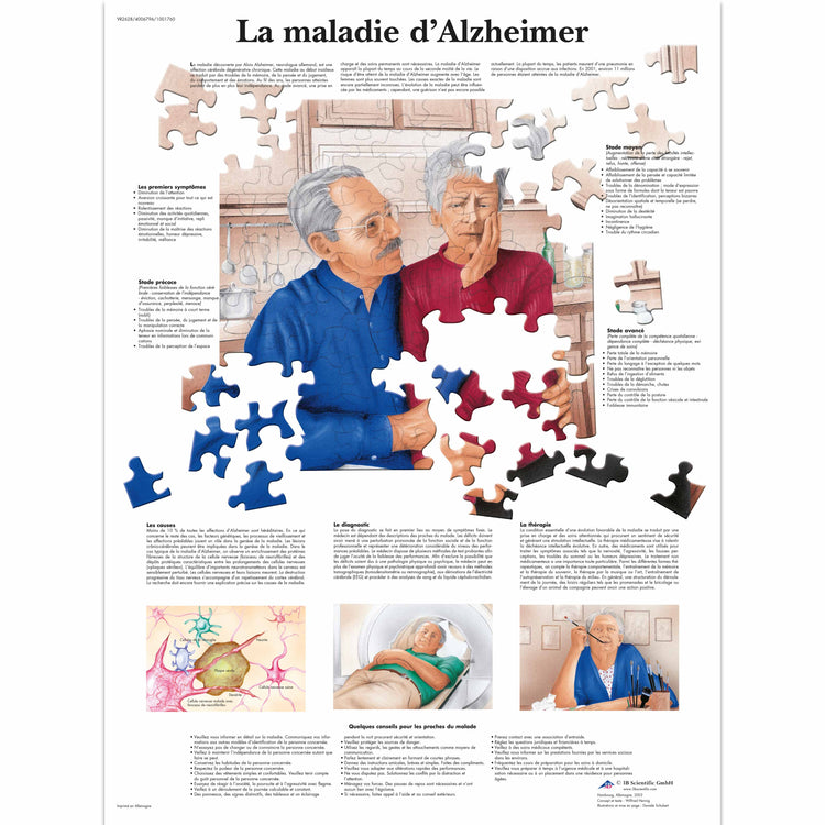 Planche anatomique - La maladie d'Alzheimer - Anatomie et pathologie - 3B Scientific